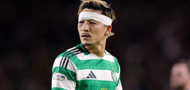 يمكن أن يرى سيلتيك قبول عرض بقيمة 4 ملايين جنيه إسترليني للتوقيع على ترقية إلى Maeda